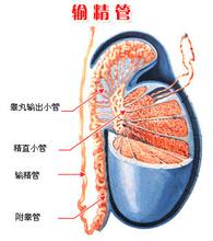 精子遇阻，输精管堵塞怎能获好“孕”？