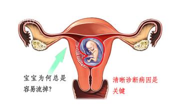 流产几年总是不怀孕是怎么回事